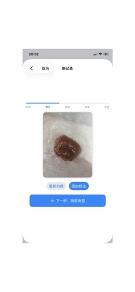 StomaLog Screenshots 4